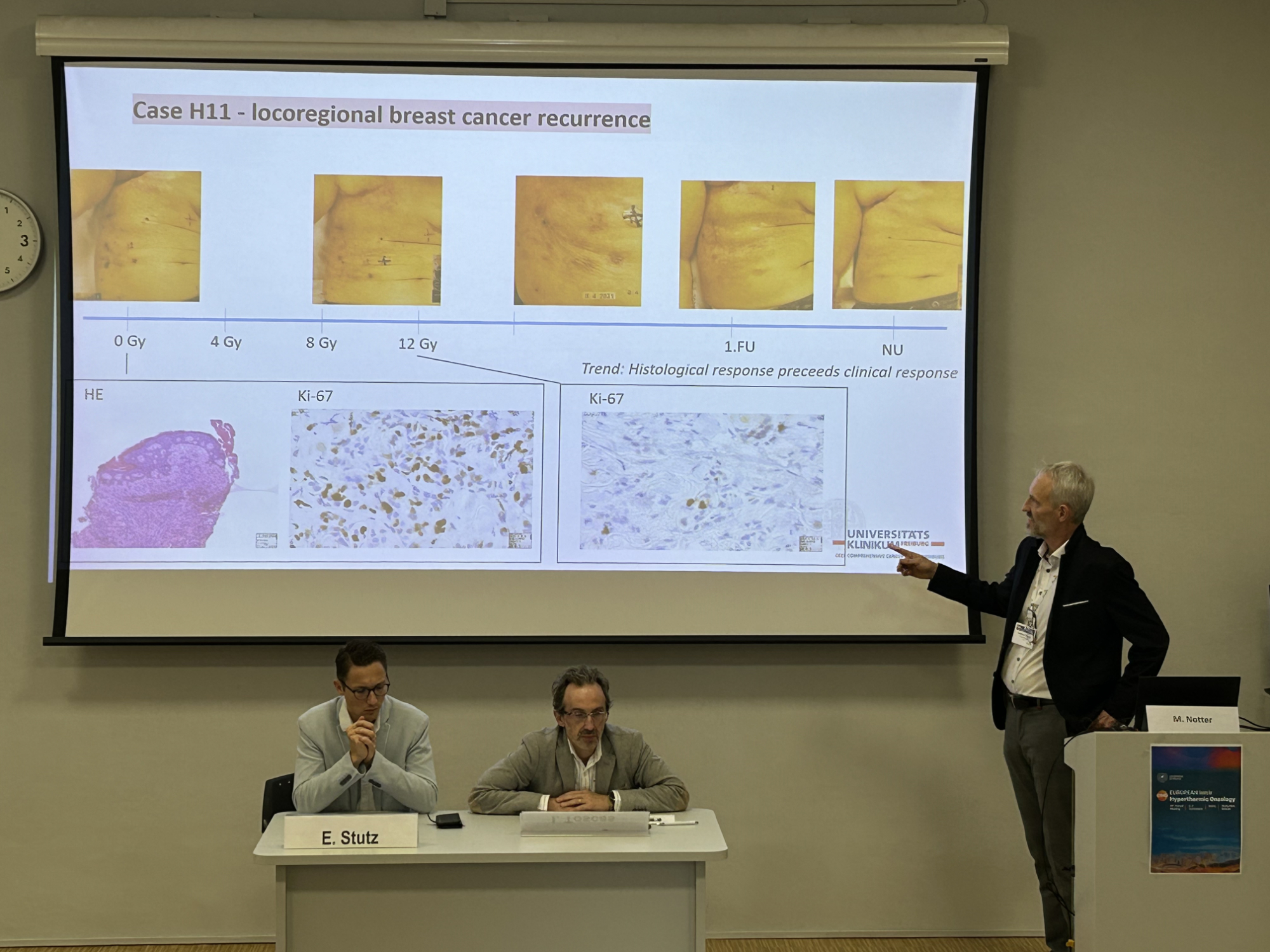 ESHO24 Lecture of Dr Andreas Thomsen on HISTOTHERM study in Freiburg heckel news 2025 ESHO24 Lecture of Dr Andreas Thomsen on HISTOTHERM study in Freiburg